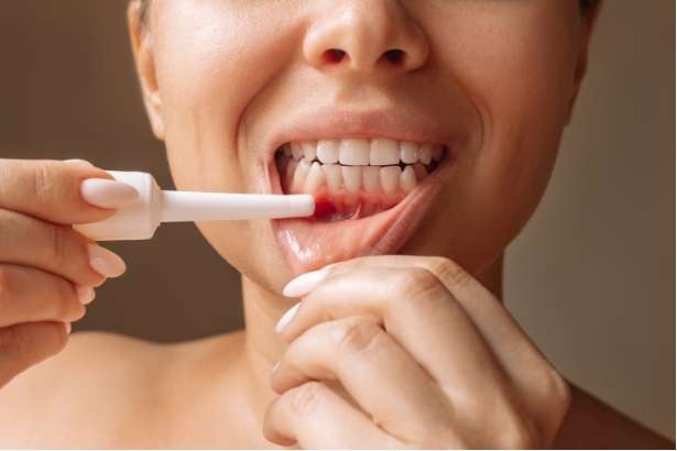 The Facts of Gum Disease