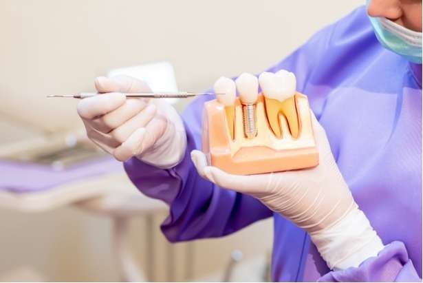 Replacing Missing Teeth: Dentures vs. Dental Implants