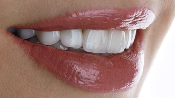 Porcelain Veneers Can Give You a Hollywood Smile