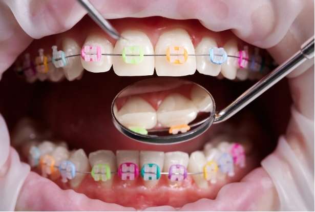 Know Your Dental Specialties: Orthodontist