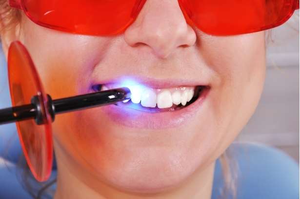 What Are Tooth Fillings Made Of? (Hint: Not Frosting!)