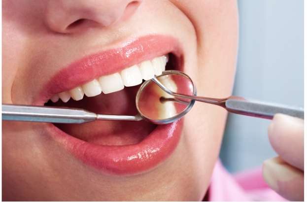 Expert Dental Filling Procedure Dentist performing a dental filling