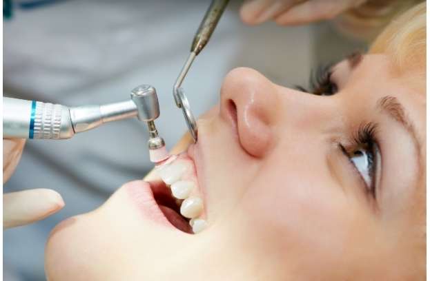Professional Polishing Dentist polishing teeth with a specialized tool