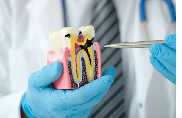Tooth cross-section showing dental pulp